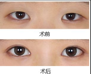 鄭州去黑點(diǎn)哪家醫(yī)院好？揭秘最受歡迎的黑點(diǎn)去除醫(yī)院