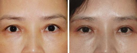 上海激光美容醫(yī)院排名及熱門選擇，哪家好？