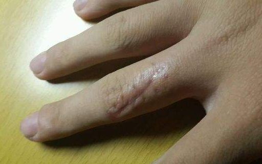 上海哪家醫(yī)院做肋骨鼻子整形手術(shù)好？