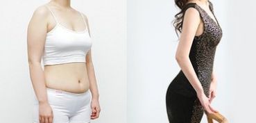 成都做雙眼皮，哪家醫(yī)院專業(yè)可靠？