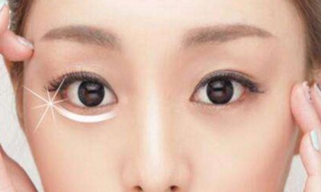 荊州割眼袋哪家醫(yī)院好？眼袋修復(fù)專家為您推薦！