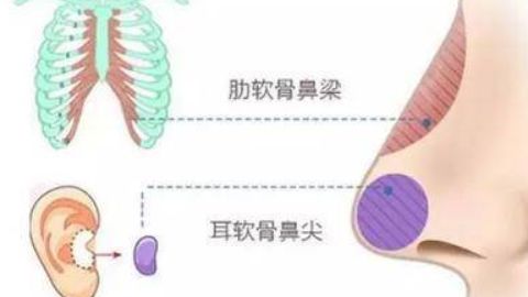 廣州有哪些醫(yī)院可以進(jìn)行抽脂手術(shù)？