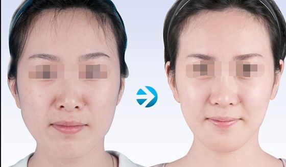 【2023北京哪家醫(yī)院做皮秒好？皮秒技術(shù)排行榜推薦】