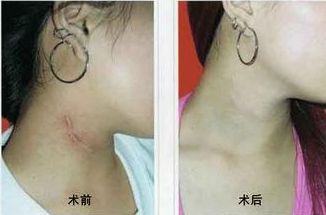 南寧哪家醫(yī)院治痘效果好？選擇明星們的美肌秘密推薦的南寧優(yōu)質(zhì)醫(yī)院