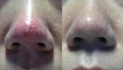 福州哪家醫(yī)生做隆胸技術(shù)好？推薦五位專業(yè)醫(yī)師，價格參考！