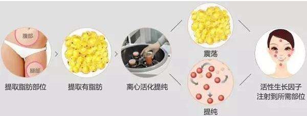 哈爾濱哪家醫(yī)院的去皺針效果好？
