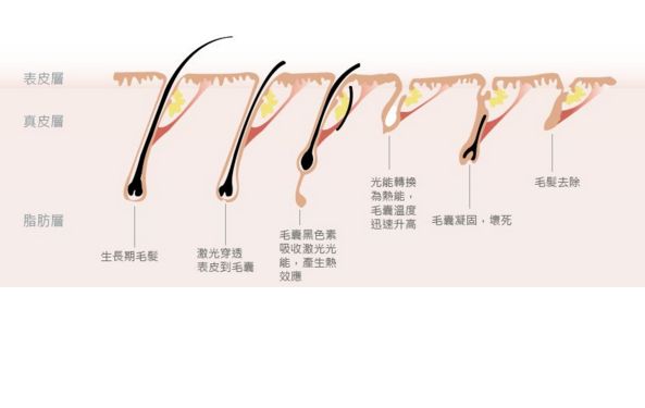 深圳哪家激光祛斑醫(yī)院口碑好？