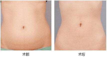 2023湘潭彩光美白嫩膚專家前10位排行榜(劉佑文、熊宜文、熊志能幫你圓夢)