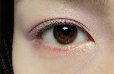 王世虎拉皮和脂肪填充的效果如何？有哪些多樣化的項(xiàng)目值得選擇？技術(shù)是否可靠可證？