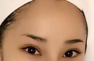 上海醫(yī)院最好治療皮膚疤痕的?？剖悄募?？