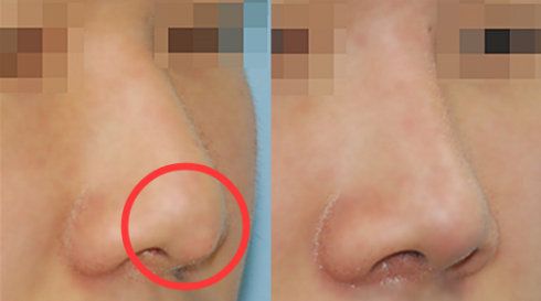 福州哪家醫(yī)院做疤痕好？比較全面的福州疤痕治療醫(yī)院推薦給您！