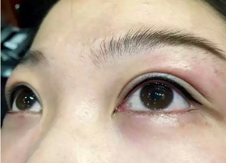 辛敏強的豐胸效果怎么樣？北京八大處整形專家綜合評估！避雷指南~
