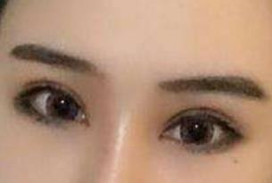 貴陽梁安裕醫(yī)生技術(shù)在線解析腹壁成型效果，怎么樣？