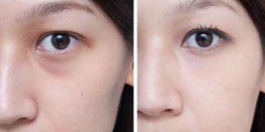 武漢看胎記醫(yī)院哪家好？綜合醫(yī)療機構(gòu)排行榜詳細解讀