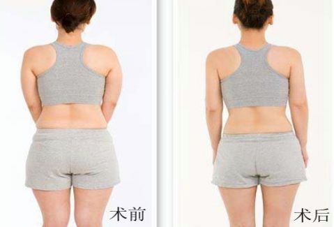 洛陽雙眼皮好的醫(yī)院有哪些？
