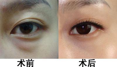 劉國權(quán)主刀，解讀成都醫(yī)美整形醫(yī)院的口碑與服務(wù)質(zhì)量