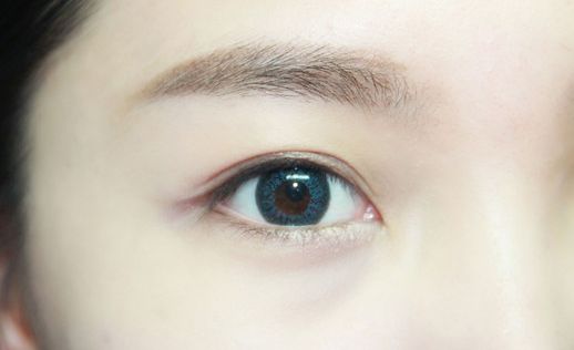 寧波眼周細(xì)紋填充醫(yī)院口碑前十名大盤(pán)點(diǎn)
