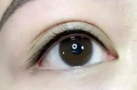 馬桂娥面頰填充脂肪能打造自然輪廓，挺陽高效！醫(yī)生背景介紹必讀！