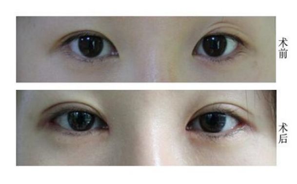 天津修復(fù)唇腭裂的醫(yī)院哪家好？專業(yè)解讀！