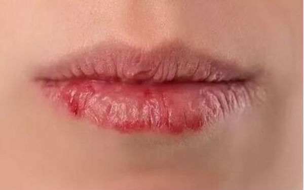 2023石家莊做眼袋手術(shù)評(píng)分十強(qiáng)醫(yī)生(王晶晶、種冬至、宋倩都是行業(yè)內(nèi)的佼佼者！)
