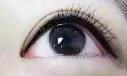 廣州曙光醫(yī)學美容醫(yī)院的黎凍抗衰老療法有多出色？