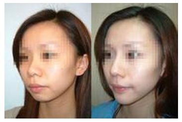 秦皇島美容美體哪家好？刷爆朋友圈的秘密美容院大揭秘！