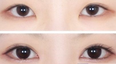 ?？谧雎”轻t(yī)院哪家好？?？谀募艺葆t(yī)院的鼻部整形效果好且口碑贊？