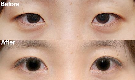 2023廣州玻尿酸面部皺紋填充專家綜合實力排行榜(李政祐、陳美運、羅曉慧這些醫(yī)生名氣都很大！)