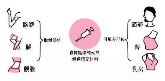 成都潘紅偉吸脂手術(shù)效果如何？專家解讀！