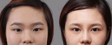 合肥哪家處女膜修復(fù)醫(yī)院靠譜又專業(yè)？