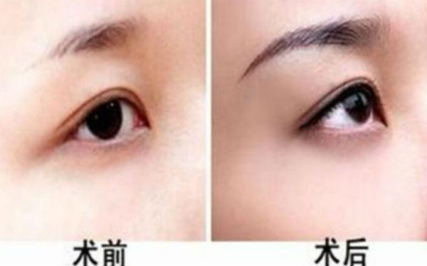 西京醫(yī)院超贊整形醫(yī)生與驚人隆鼻案例，受歡迎至極！