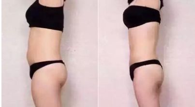 石家莊整容整形醫(yī)院哪家好？全面評測幫您選擇最佳醫(yī)療機構(gòu)！