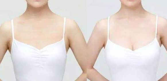威海假體豐胸醫(yī)院哪家好？從專家口碑、手術(shù)效果看威海頂級(jí)醫(yī)院推薦！
