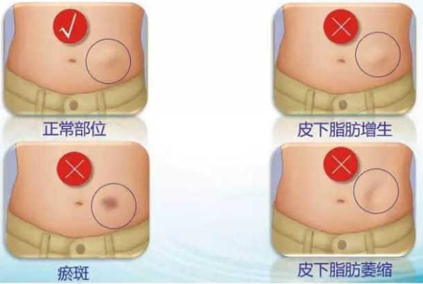 哈爾濱整形醫(yī)院哪家好？選擇哈爾濱整容醫(yī)院前必知的五大關(guān)鍵點(diǎn)
