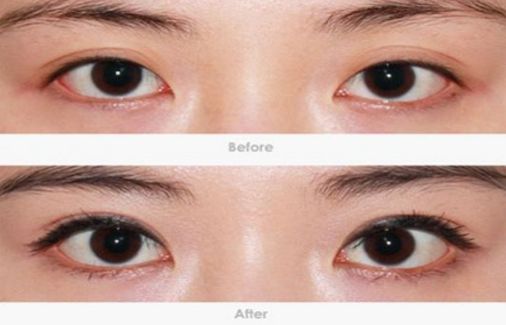 柳州哪家醫(yī)院做疤痕切除好？-獨家分享柳州疤痕切除醫(yī)院排行榜