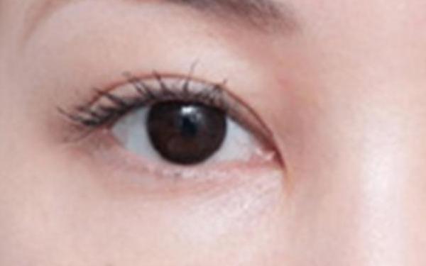 廣州哪家醫(yī)院做隆胸手術(shù)技術(shù)高？醫(yī)生資深經(jīng)驗來看詳細(xì)介紹！