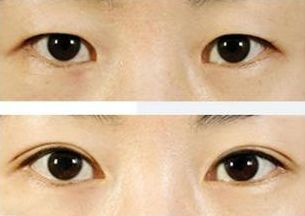 上海治療青春痘的專家推薦，哪家醫(yī)院效果最佳？