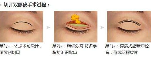 淮安光子嫩膚醫(yī)院哪家好？專家為您推薦5家權(quán)威醫(yī)院