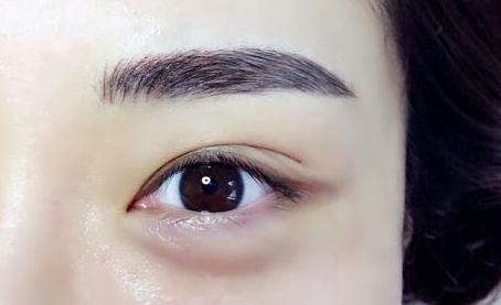 銀川有哪些專業(yè)的激光祛痘印醫(yī)院值得推薦？