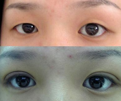 濟(jì)南哪家整形醫(yī)院的拉皮效果好且價格合適？