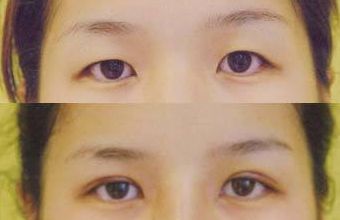 大慶微整形醫(yī)院哪家好？頂級(jí)專家為您解讀微整形醫(yī)院選擇指南！