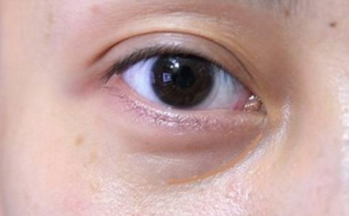 邯鄲哪家醫(yī)院做私密整形好？解析當代女性美容訴求