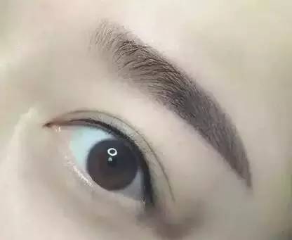 佰華利董萍的面部脂肪填充經(jīng)驗(yàn)，展現(xiàn)自然少女感