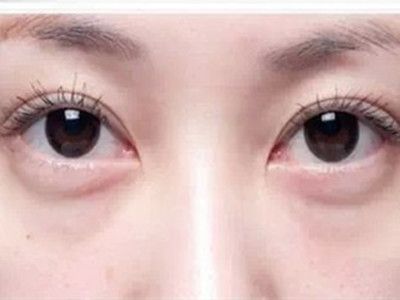寧波祛斑哪家醫(yī)院好？精選寧波祛斑專業(yè)醫(yī)院推薦！