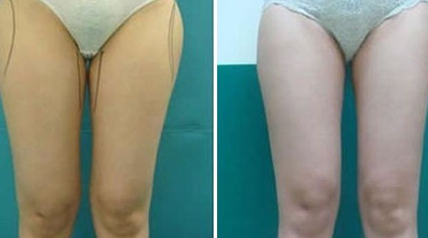 揭陽激光美容醫(yī)院哪家好？選擇揭陽最佳激光美容醫(yī)院的7個(gè)關(guān)鍵要素！
