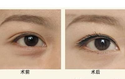 寧波隆鼻Top5醫(yī)生：技術(shù)精湛，聲譽卓越，口碑贊不絕口！
