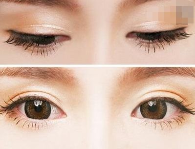 西寧豐胸整形醫(yī)院排名前三，專業(yè)醫(yī)生推薦！