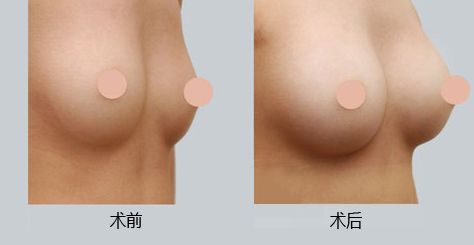 西安墊鼻梁技術(shù)好的醫(yī)院有哪些？