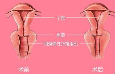 長(zhǎng)沙靠譜矯正醫(yī)院哪家好？解答你所有的疑慮！