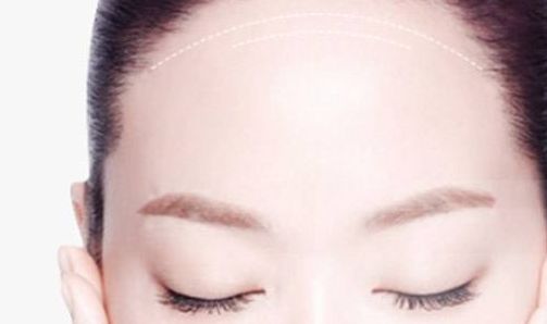 南京做修復(fù)雙眼皮哪家好？解析南京修復(fù)雙眼皮的最佳選擇
